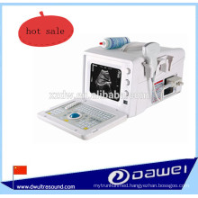 portable medical ultrasound machine & cheapest ultrasound scanner